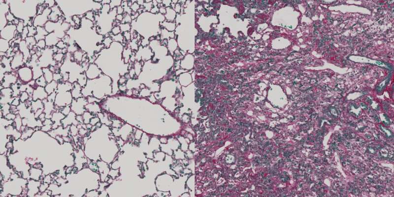 Immunotherapy reduces lung and liver fibrosis in mice