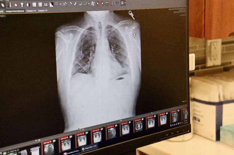 In this January 12, 2022, handout image courtesy of Northwestern Medicine, a computer screen displays an X-Ray of Albert Khoury'