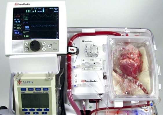 Innovative 'heart in a box' technology gives hope to transplant patients