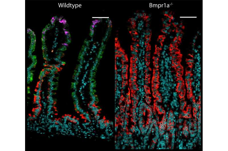 Intestinal cells change functions during their lives