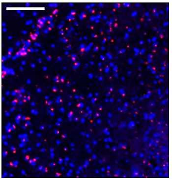 Iron accumulation linked with age-related cognitive decline