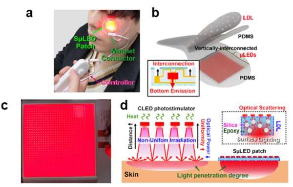 KAIST team develops surface-lighting MicroLED patch with significant melanogenesis inhibition effect