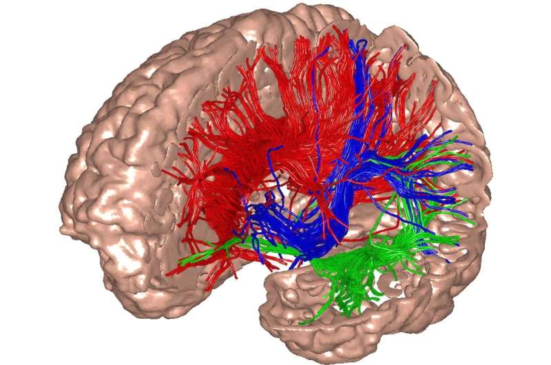 Ketamine found to increase brain noise