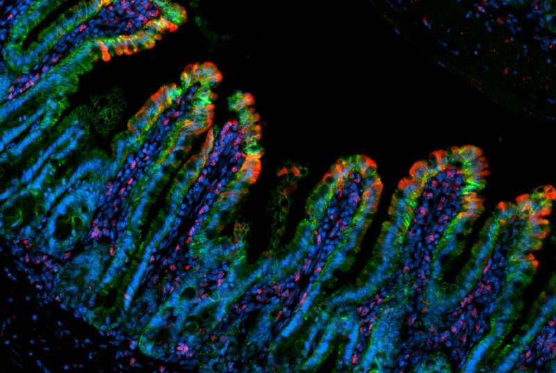 Key growth factor protects gut from inflammatory bowel disease