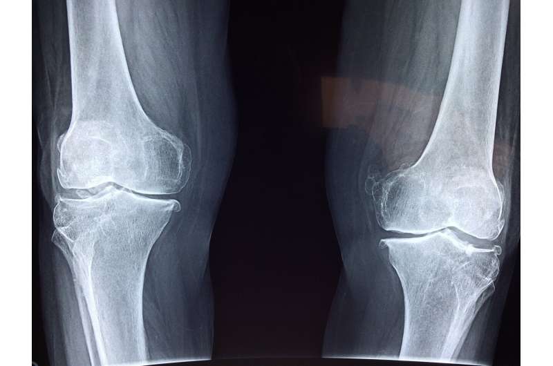 knee bone