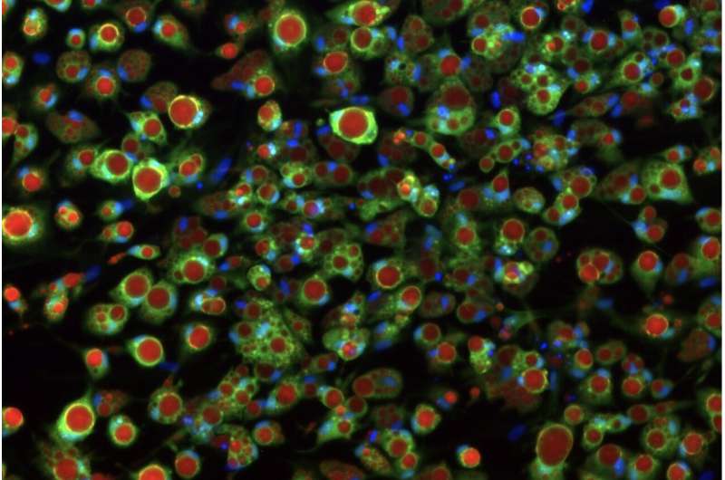 Lab-grown fat cells help scientists understand type 2 diabetes