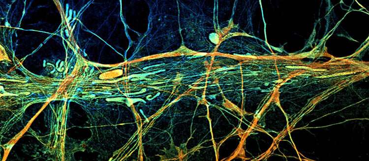 Limiting energy in neurons exacerbates epilepsy