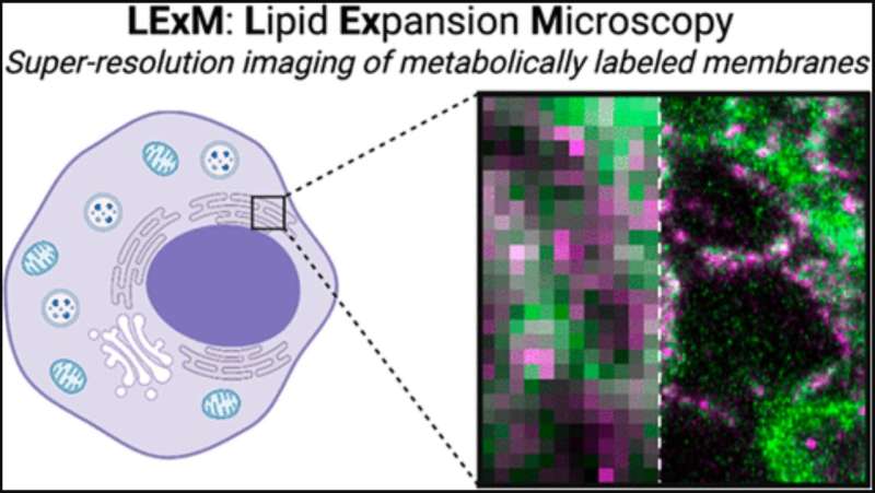 Lipid expansion microscopy uses 'power of click chemistry'