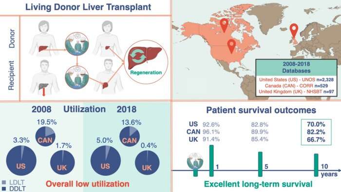 Living donor transplantation offers a safe alternative for liver transplant patients