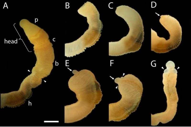 Looking to the acorn worm for clues: Why vertebrates cannot regenerate their bodies