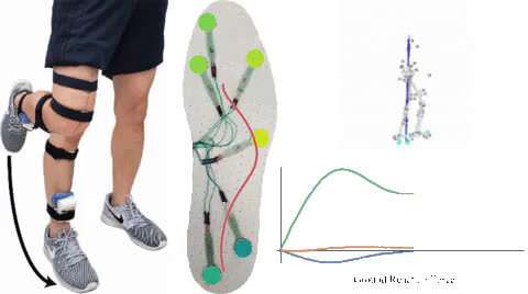 Low-cost, sensor-equipped insole to monitor gait of patients with mobility impairments