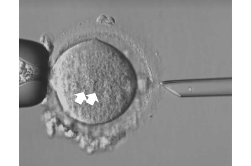 'Maeve's law' would let IVF parents access technology to prevent mitochondrial disease—ere's what the Senate is debating