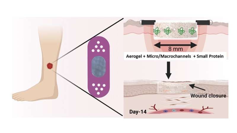Microchannel-containing nanofiber aerogels with small protein molecule enable accelerated diabetic wound healing