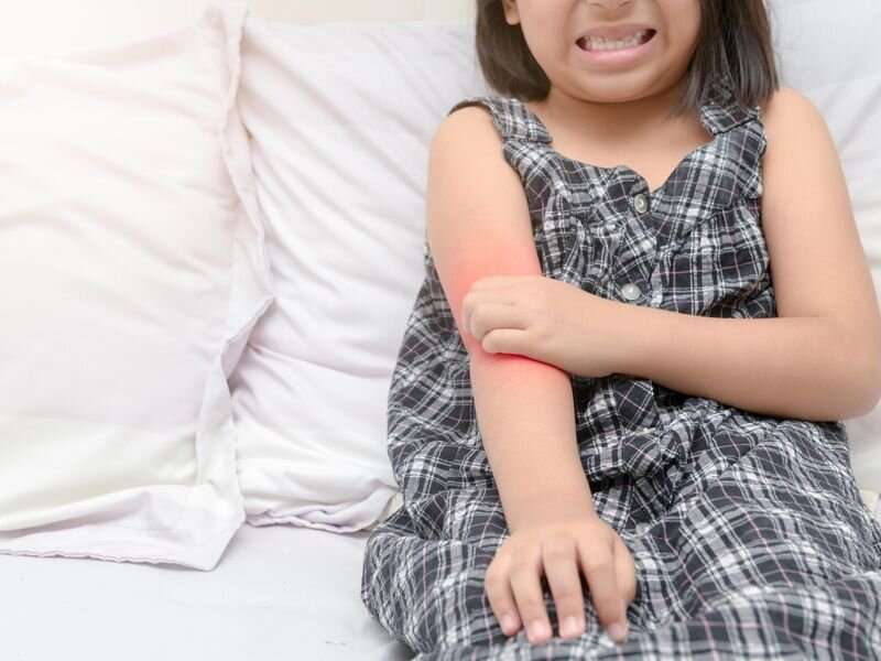 Mild eczema in first grade likely to resolve by sixth grade
