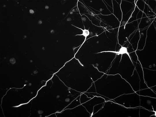 Modeling the growth process of neurons