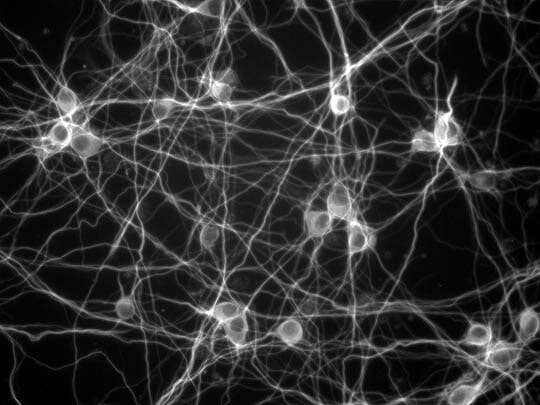Modeling the growth process of neurons