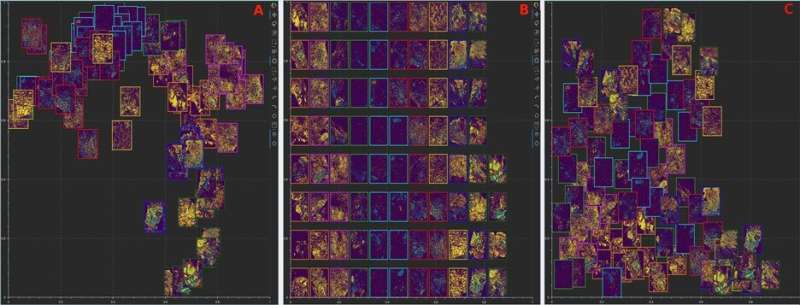 Moffitt researchers create software program that allows simultaneous viewing of tissue images through dimensionality reduction