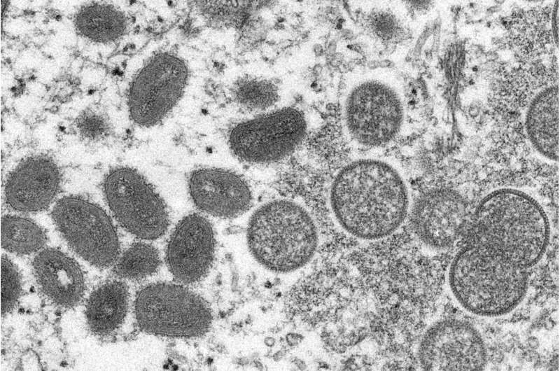 Monkeypox virus could become entrenched as new STD in the US