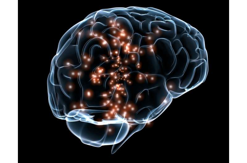 Nanoparticles can improve stroke recovery by enhancing brain stimulation, study shows
