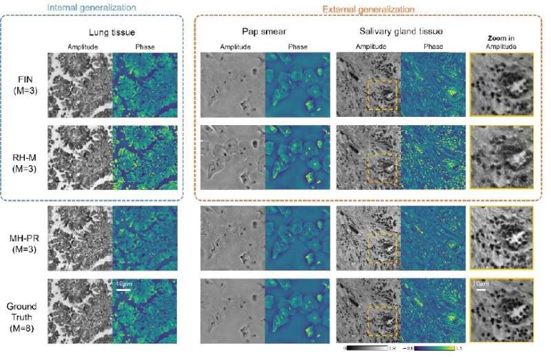 Neural network speeds holographic image reconstruction for biological samples