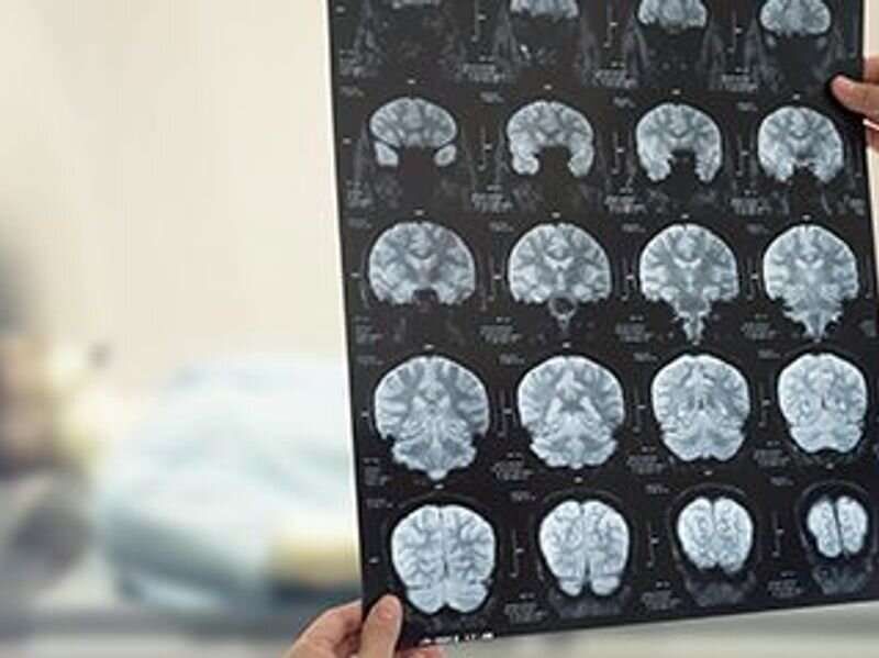 Neuroimaging use in ischemic stroke examined for medicare patients