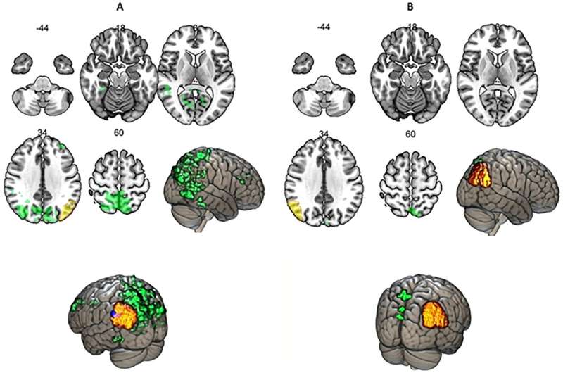 Neurolinguists report not two, but three options for brain functional categories