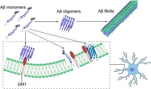 Neuron membrane lipid may contribute to Alzheimer’s development, progression
