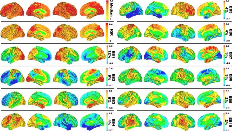 New computational model proposed for Alzheimer's disease