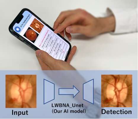 New deep-learning model helps the automated screening of common eye disorders