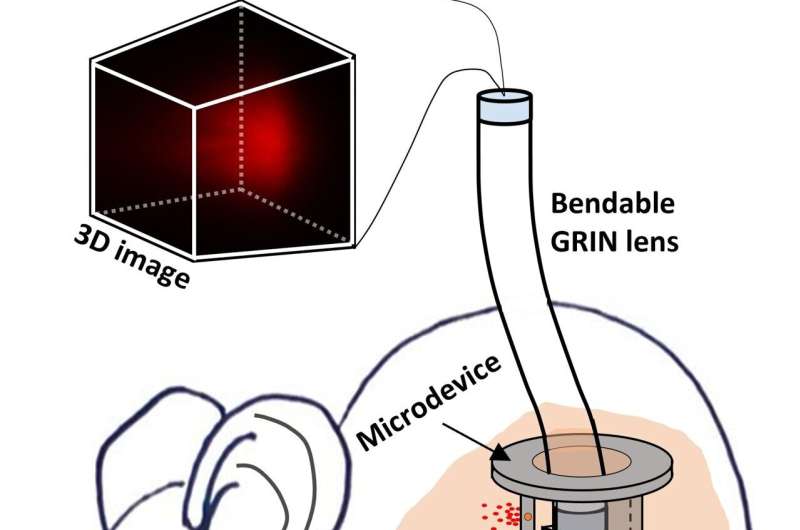 New endoscope uses bendable GRIN lens for 3D microscopy