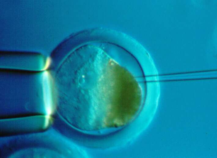 امید باروری جدید برای پسران IVF