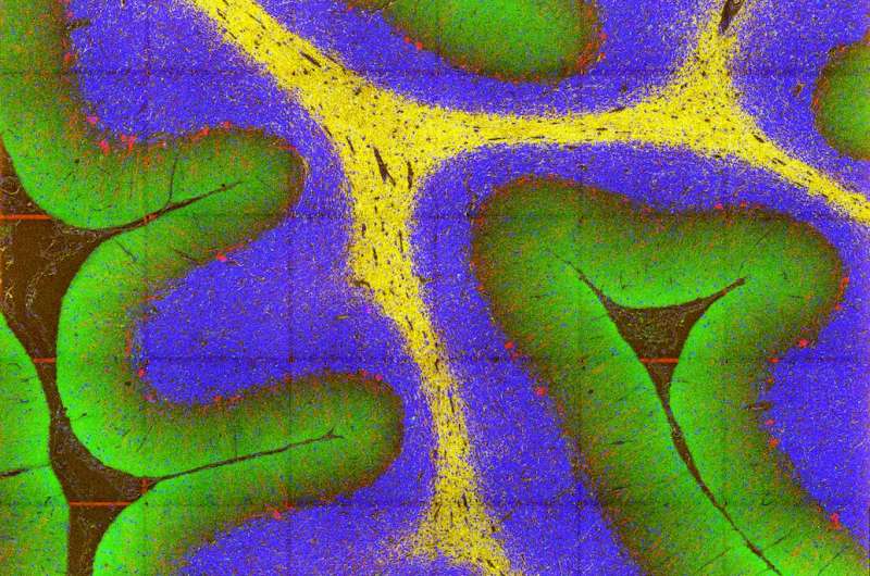 New imaging tool unravels the brain's complex machinery in health and disease
