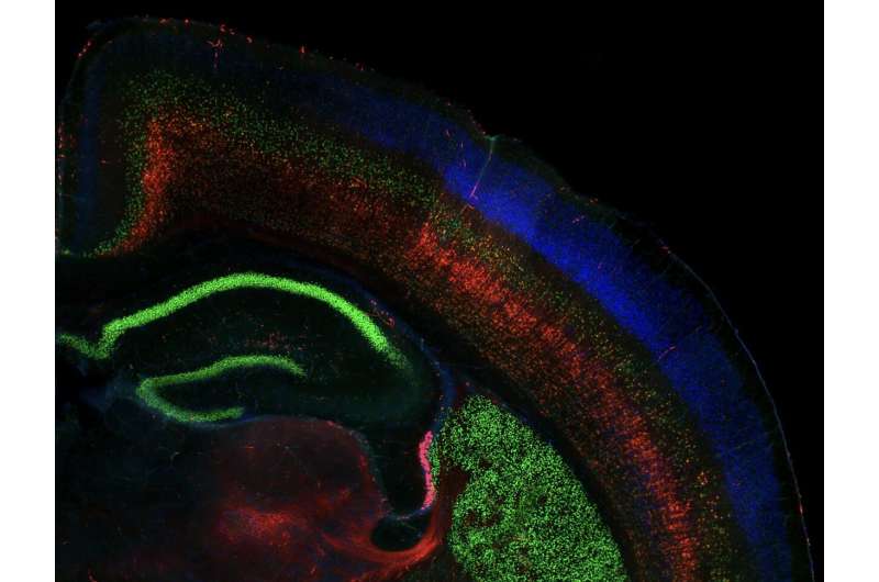 New insight about the regulatory mechanisms underpinning the development of cortical neurons