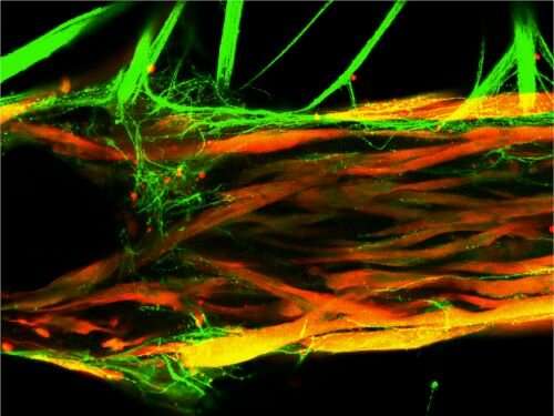 New method allows for realistic, 3D model of this human synapse