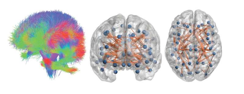 New method for measuring brain activity could help multiple sclerosis patients