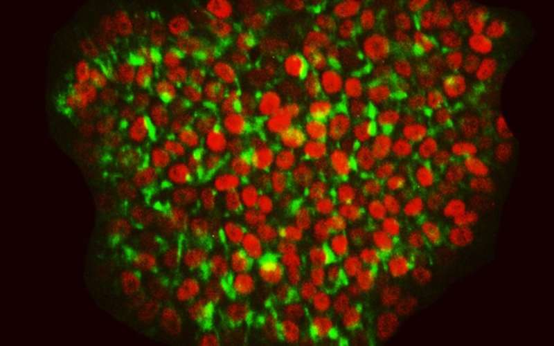 Peluang baharu untuk penyelidikan sel stem: Pengeluaran sel stem pluripotent manusia yang semakin cekap