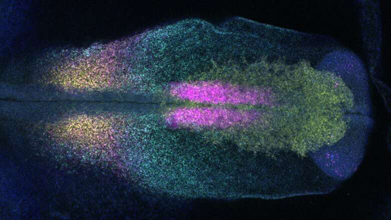 New research uncovers key factor controlling ear development at early stages