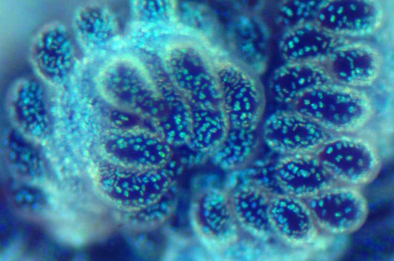 New species of octocoral the jewel of Caloundra