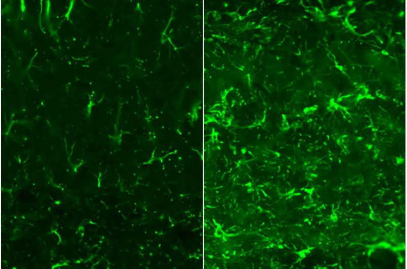 New strategy reduces brain damage in Alzheimer's and related disorders, in mice