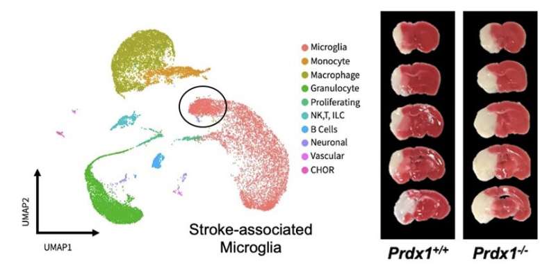 New study identifies unique type of microglia associated with stroke in the I/R injured brain