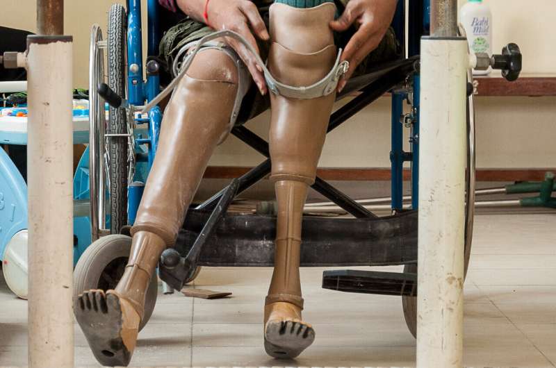 New study shows how prosthetics care in Cambodia is changing