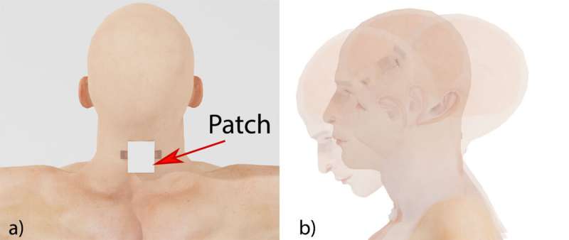 New wearable sensor to measure neck strain may detect potential concussion