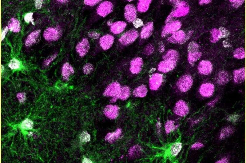 Newborn cells in the epileptic brain provide a potential target for treatment