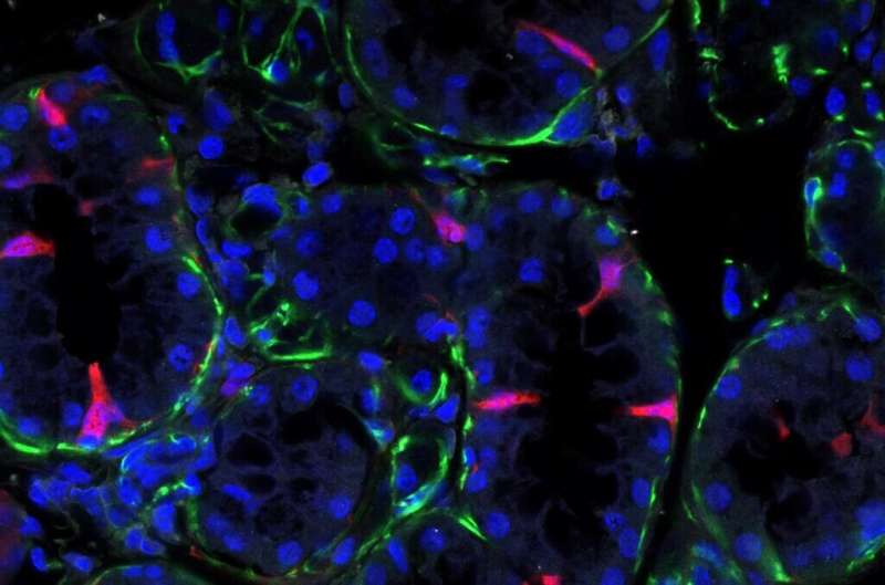 Newly identified cell type could be the key to restoring damaged salivary glands