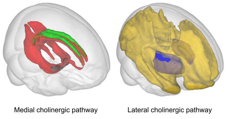 Novel imaging marker reveals very early brain changes in Alzheimer's disease