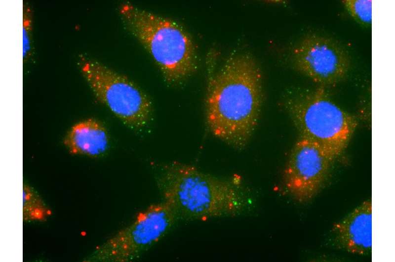 Novel nanoparticles deliver innovative cancer chemoimmunotherapy
