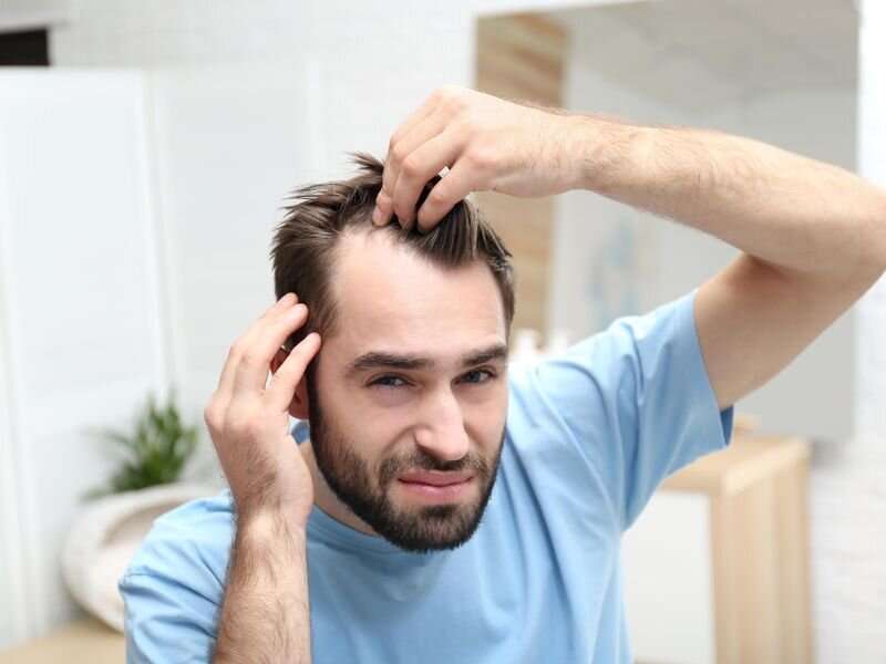 Nutritional supplements may have role in hair loss treatment
