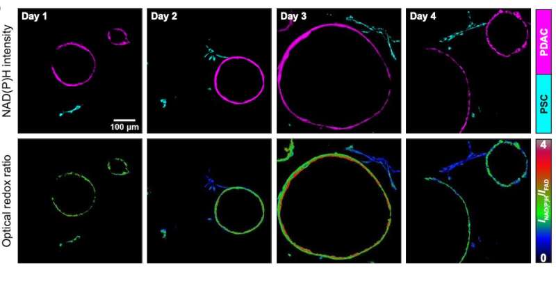 Optical imaging highlights metabolic interactions that make pancreatic tumor cells grow