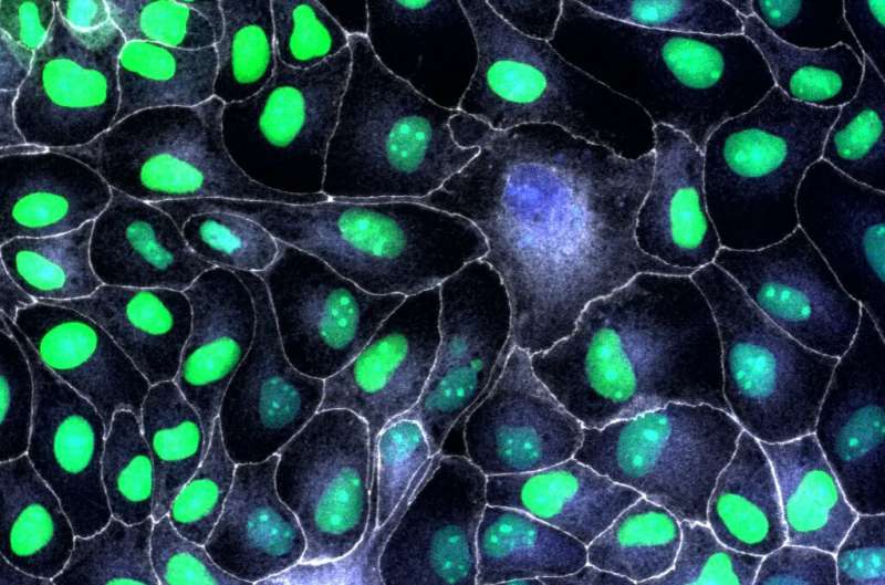 P53 protein plays a key role in tissue repair, study finds