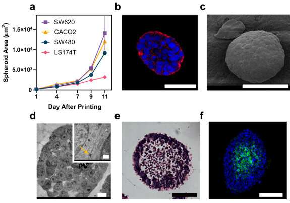 Patient-specific cancer tumours replicated in 3D bioprinting advance